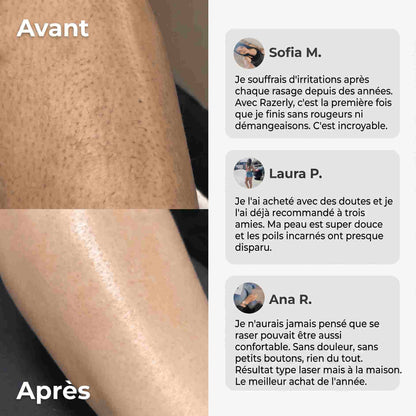 Rasoir 2-en-1 Bikini et Corps Vlustra™