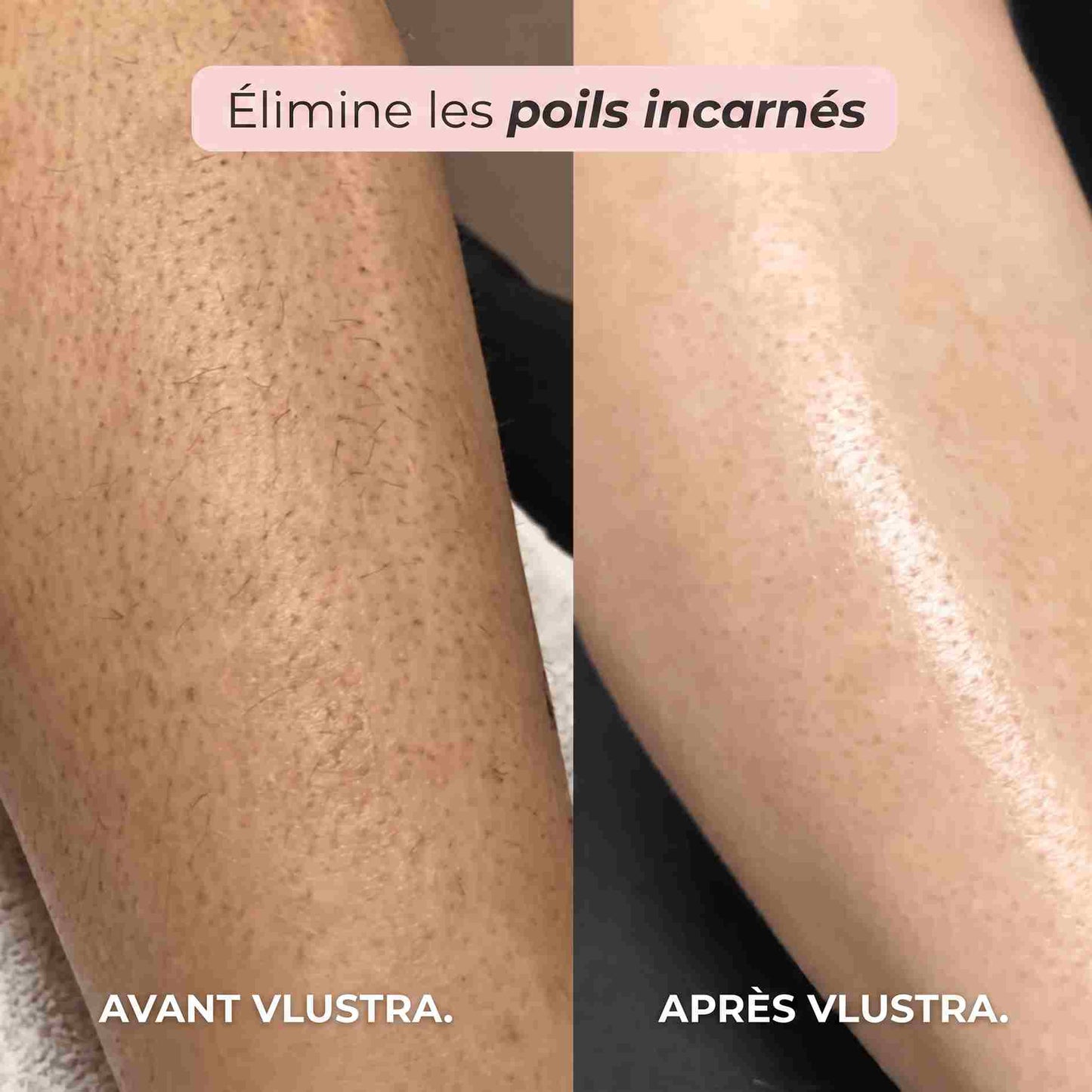 Rasoir 2-en-1 Bikini et Corps Vlustra™